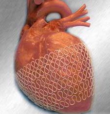 HeartNet