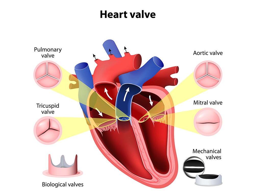 How to Treat Heart Disease How to Treat Heart Disease