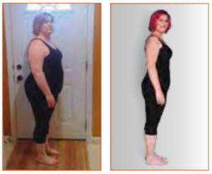 female patient before and after losing weight