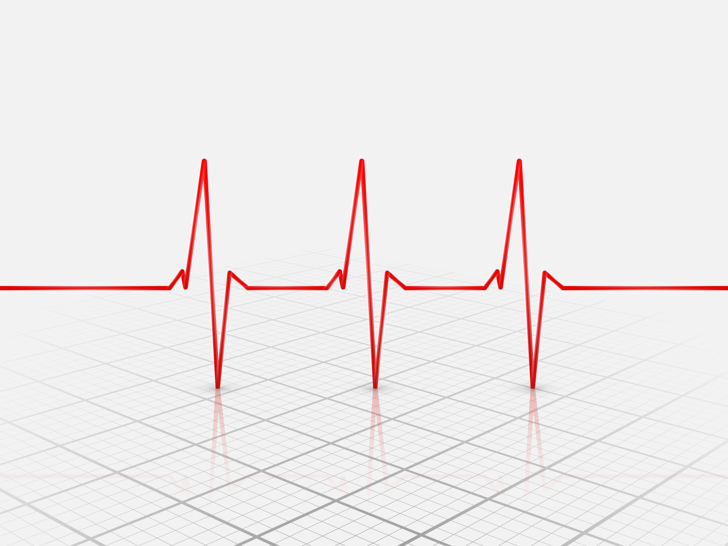 FIRM Ablation Mapping the Heart to Treat Atrial Fibrillation Inova Newsroom