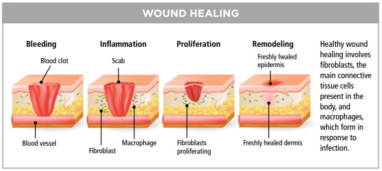diagram of wound healing stages