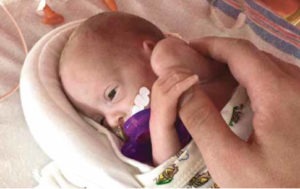 photo of a tiny preemie baby, smaller than an adult hand
