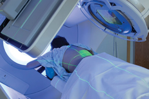 Stereotactic body radiation therapy (SBRT) delivers precisely focused radiation to tumors.
