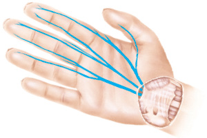 Peripheral nerve injuries