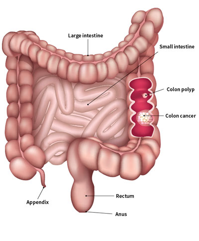 colorectal screening